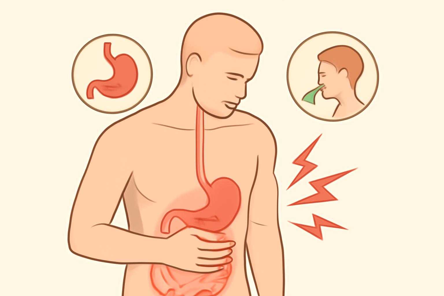 腹痛や吐き気など、アニサキス感染による体の不調を表現した医学的なイラスト